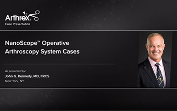 NanoScope™ Operative Arthroscopy System Cases 