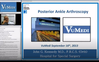 Posterior Ankle Arthroscopy VuMedi 