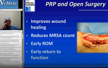 PRP for Achilles Injuries VuMedi 