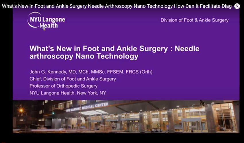What's New in Foot and Ankle Surgery Needle Arthroscopy Nano Technology How Can It Facilitate Diag
                